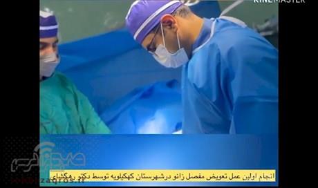 نخستین عمل جراحی تعویض مفصل زانو در شهرستان کهگیلویه انجام شد